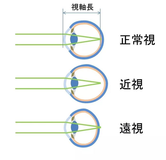 首先,可以通过手机app查眼睛的屈光度(说白了就是查视力).