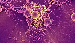癌症母婴传播？NEJM报道宫颈癌母亲顺产导致小儿肺癌两例