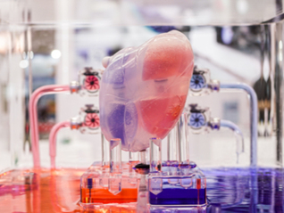 IPO雷达|“人工心脏”价格走低，核心医疗产品商业化难题待解